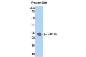 Image no. 1 for anti-Keratin 1 (KRT1) (AA 350-488) antibody (ABIN1172987)