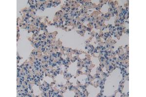 Image no. 2 for anti-Fatty Acid Binding Protein 5 (Psoriasis-Associated) (FABP5) (AA 2-135) antibody (ABIN1078019)