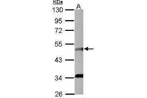 WB Image Sample (30 ug of whole cell lysate) A: HCT116 10% SDS PAGE antibody diluted at 1:2000