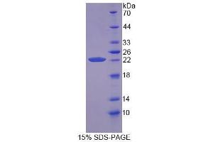 Image no. 1 for Cyclophilin B (PPIB) (AA 47-216) protein (S tag,His tag) (ABIN6236617)