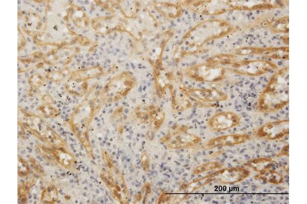 FHOD1 antibody  (AA 1-1164)