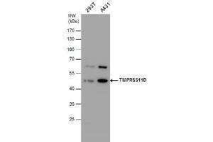 WB Image TMPRSS11D antibody detects TMPRSS11D protein by western blot analysis.