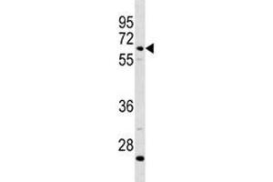 Image no. 2 for anti-Complement Component 8, beta Polypeptide (C8B) (AA 393-422) antibody (ABIN3028577)
