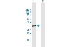 Image no. 1 for anti-MRG-Binding Protein (MRGBP) (AA 1-204) antibody (ABIN949439)