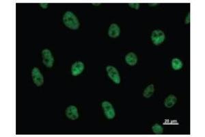 Image no. 2 for anti-CDC5 Cell Division Cycle 5-Like (S. Pombe) (CDC5L) antibody (ABIN933108)