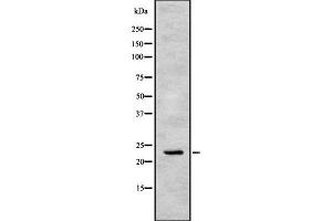 Image no. 2 for anti-Apolipoprotein B mRNA Editing Enzyme, Catalytic Polypeptide-Like 3C (APOBEC3C) antibody (ABIN6259986)