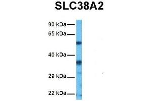 Image no. 2 for anti-Solute Carrier Family 38, Member 2 (SLC38A2) (N-Term) antibody (ABIN2777727)