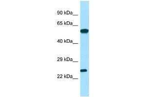 Image no. 1 for anti-Deoxyguanosine Kinase (DGUOK) (C-Term) antibody (ABIN2789830)