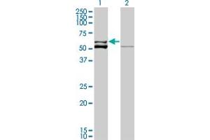 Western Blot analysis of GLUD2 expression in transfected 293T cell line by GLUD2 monoclonal antibody (M01), clone 3C2.