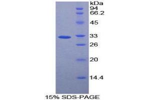 Image no. 1 for Caspase 12 (Gene/pseudogene) (CASP12) (AA 1-244) protein (His tag) (ABIN1878851)