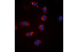 Immunofluorescent analysis of BAD (pS155) staining in Hela cells.