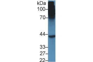 Image no. 2 for anti-Sex Hormone Binding Globulin (SHBG) (AA 219-358) antibody (ABIN1172838)