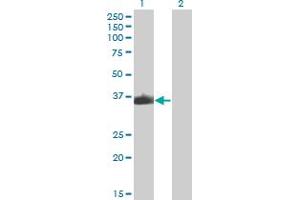 anti-Zinc Finger Protein 187 (ZNF187) (AA 1-325) antibody