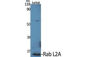 Image no. 2 for anti-RAB, Member of RAS Oncogene Family-Like 2A (RABL2A) (C-Term) antibody (ABIN3186633)
