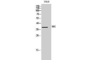 Image no. 1 for anti-Aldo-keto Reductase Family 1, Member C2 (AKR1C2) (Internal Region) antibody (ABIN3184266)