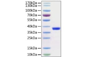 SARS-CoV-2 NSP5 (3CL-Pro) Protein (AA 1-306) (His-Avi Tag)