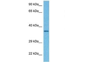 Image no. 2 for anti-Dehydrogenase/reductase (SDR Family) Member 7B (DHRS7B) (Middle Region) antibody (ABIN2782856)