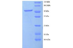 Image no. 1 for Charged Multivesicular Body Protein 2A (CHMP2A) (AA 1-222), (full length) protein (GST tag) (ABIN5712355)