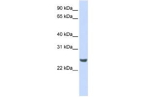 Image no. 1 for anti-NFKB Inhibitor Interacting Ras-Like 1 (NKIRAS1) (N-Term) antibody (ABIN2786171)