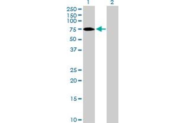 anti-Zinc Finger Protein 189 (ZNF189) (AA 1-584) antibody
