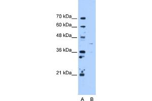 Image no. 1 for anti-Ornithine Aminotransferase (OAT) (C-Term) antibody (ABIN2783234)