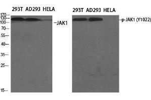 Image no. 2 for anti-Janus Kinase 1 (JAK1) (pTyr1022) antibody (ABIN3182053)