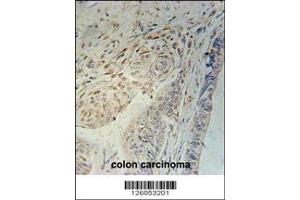 Immunohistochemistry (IHC) image for anti-Coiled-Coil Domain Containing 92 (CCDC92) antibody (ABIN2158067)