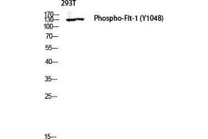Image no. 2 for anti-Fms-Related tyrosine Kinase 1 (VEGFR1) (FLT1) (pTyr1048) antibody (ABIN3182936)