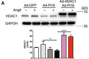 Image no. 18 for anti-Histone Deacetylase 1 (HDAC1) (Center) antibody (ABIN2854776)