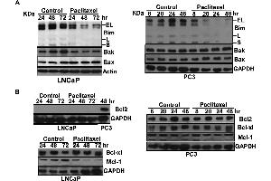 Image no. 64 for anti-Glyceraldehyde-3-Phosphate Dehydrogenase (GAPDH) (Center) antibody (ABIN2857072)