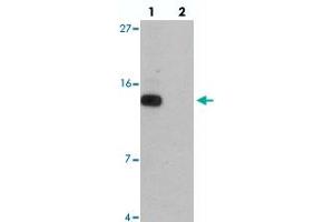 Image no. 1 for anti-DET1 and DDB1 Associated 1 (DDA1) antibody (ABIN5576481)