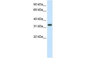 Image no. 2 for anti-E3 Ubiquitin-Protein Ligase SIAH1 (SIAH1) (C-Term) antibody (ABIN2780459)