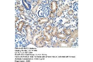 Image no. 4 for anti-Mucin 1 (MUC1) (C-Term) antibody (ABIN2776819)