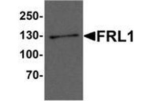 Image no. 1 for anti-Formin-Like 1 (FMNL1) (C-Term) antibody (ABIN1450026)