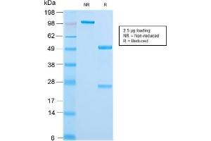 Image no. 7 for anti-Keratin 18 (KRT18) antibody (ABIN6939938)