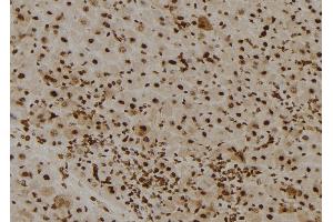 Image no. 1 for anti-Breast Cancer 2, Early Onset (BRCA2) (pSer2095) antibody (ABIN6270046)