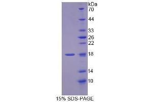 Image no. 1 for Methylmalonyl CoA Epimerase (MCEE) (AA 39-178) protein (His tag) (ABIN6239709)