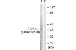 Western blot analysis of extracts from HepG2 cells treated with EGF 200ng/ml 30', using C/EBP-beta (Phospho-Thr235/188) Antibody.