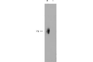 Image no. 1 for anti-Natural Killer Cell Receptor 2B4 (CD244) (Internal Region) antibody (ABIN570901)