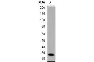 Image no. 2 for anti-Mannan Binding Protein/Mannan Binding Lectin (MBP/MBL) antibody (ABIN3222931)