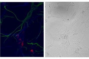 Image no. 2 for anti-Neuron-Specific Protein Family Member 1 (D4S234E) (N-Term) antibody (ABIN5539461)