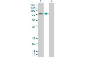 anti-Zinc Finger, SWIM-Type Containing 2 (ZSWIM2) (AA 1-633) antibody
