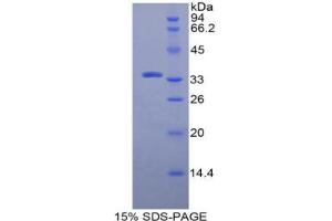 Image no. 1 for N-Methylpurine-DNA Glycosylase (MPG) protein (ABIN3010962)