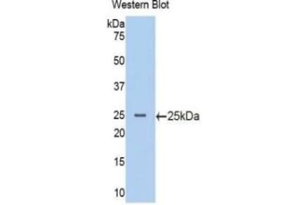 PIK3CB ELISA Kit