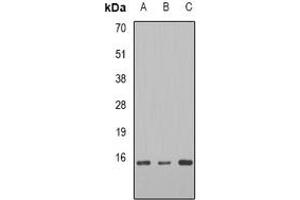 Image no. 1 for anti-Transcription Elongation Factor B (SIII), Polypeptide 2 (18kDa, Elongin B) (TCEB2) (full length) antibody (ABIN6006166)