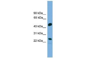 Image no. 1 for anti-Cell Division Cycle Associated 4 (CDCA4) (Middle Region) antibody (ABIN2784258)