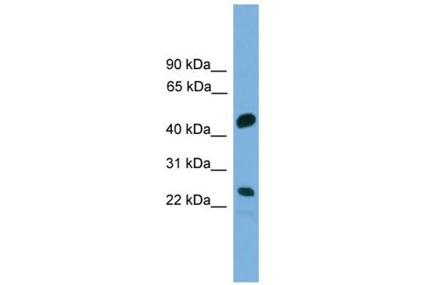 anti-Cell Division Cycle Associated 4 (CDCA4) (Middle Region) antibody