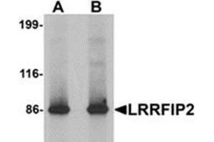 Image no. 1 for anti-Leucine Rich Repeat (In FLII) Interacting Protein 2 (LRRFIP2) (C-Term) antibody (ABIN783417)