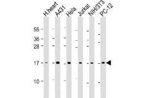 Image no. 2 for anti-Ubiquitin-Conjugating Enzyme E2I (UBE2I) antibody (ABIN387788)
