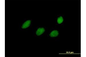 Image no. 2 for anti-Transcription Elongation Factor A (SII)-Like 4 (TCEAL4) (AA 1-215) antibody (ABIN529133)